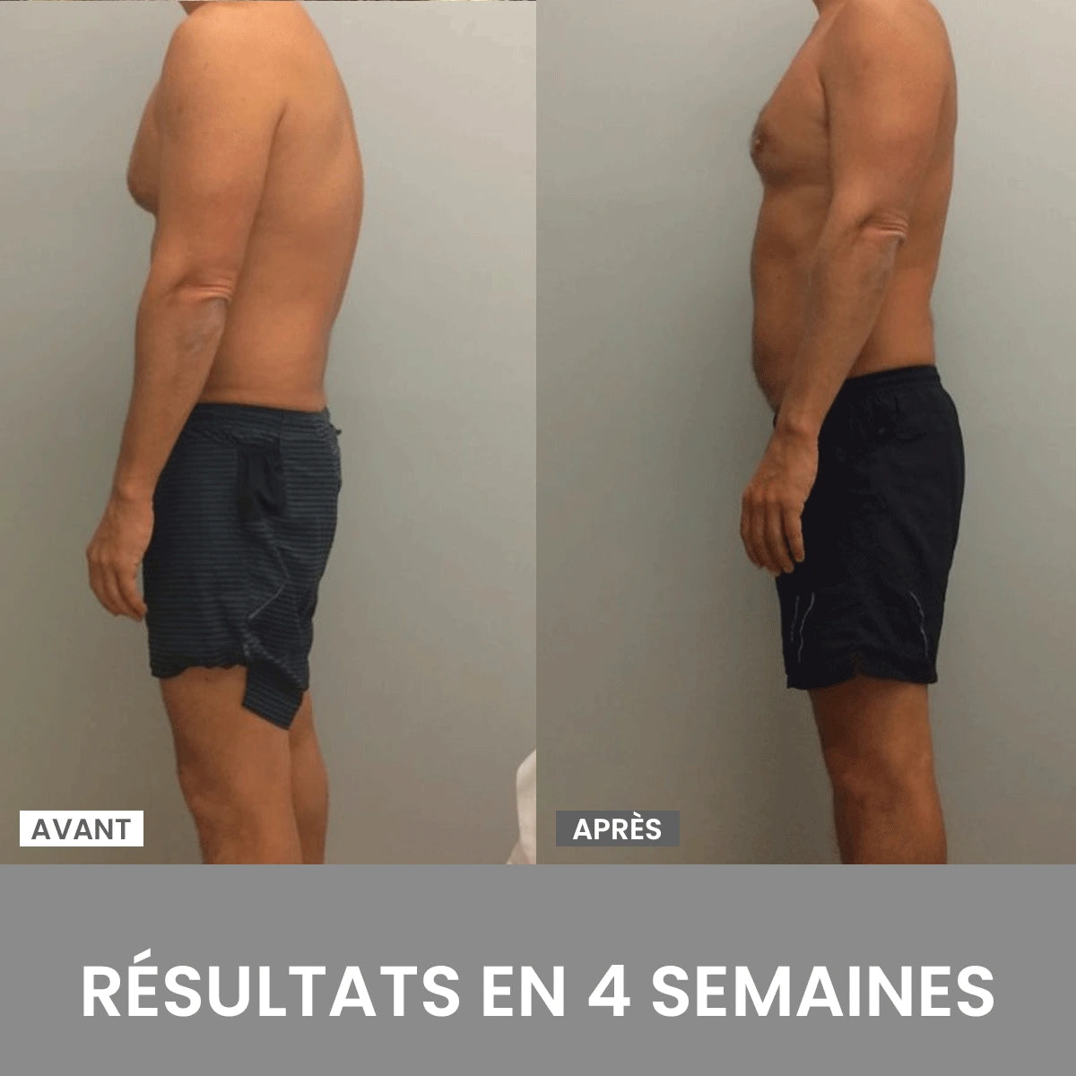 Corrector de postura OrthoPos® (Compre 1 y reciba 1 gratis)